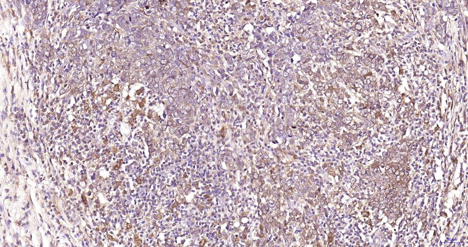 GPX4 Recombinant Rabbit mAb(bs