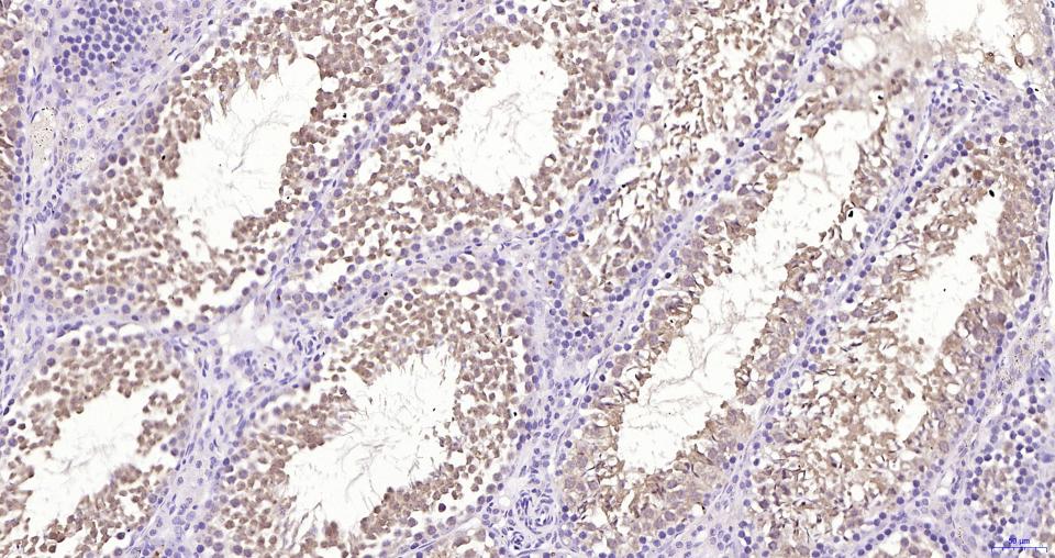 GPX4 Recombinant Rabbit mAb(bs