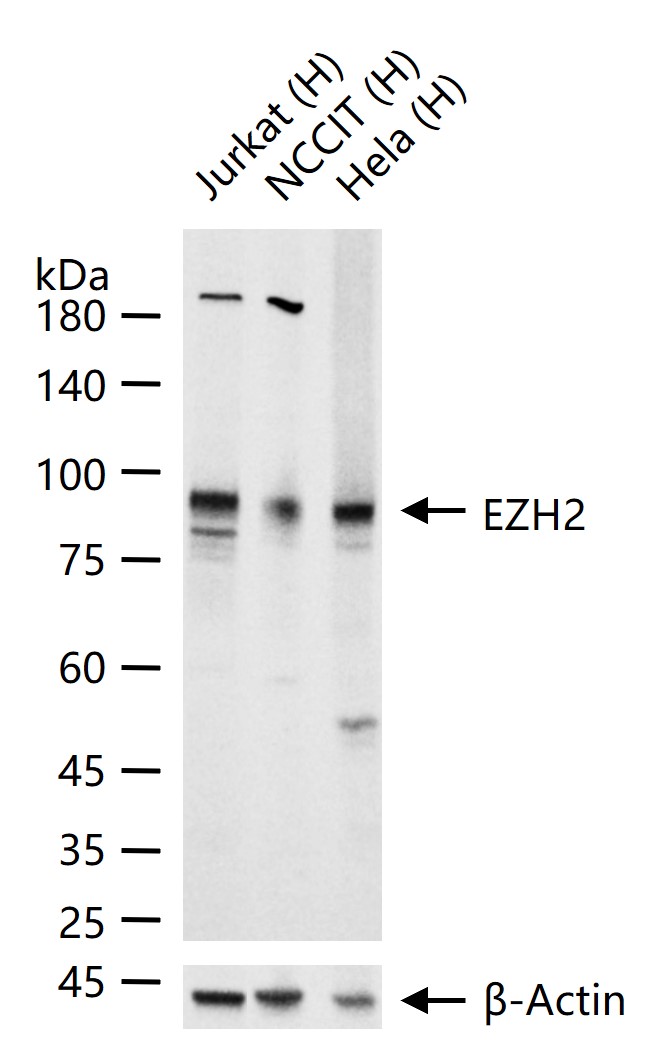EZH2 Recombinant Rabbit mAb(bs