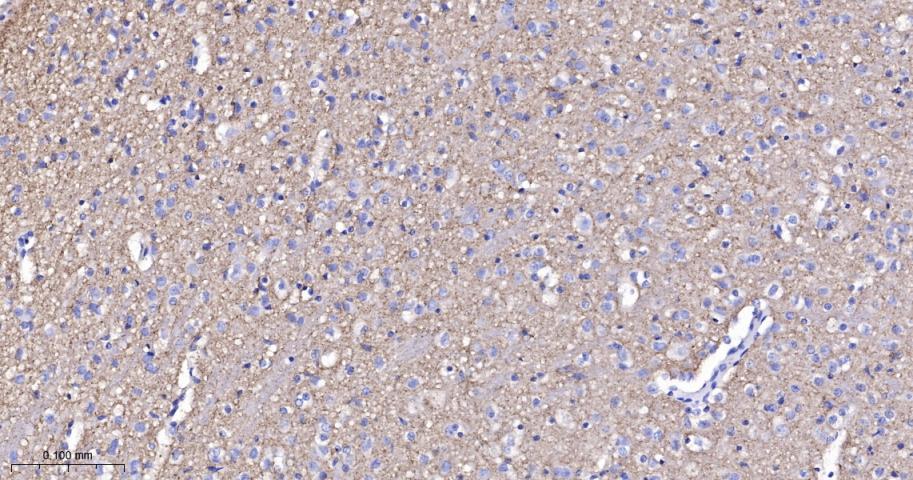 Synapsin II Recombinant Rabbit