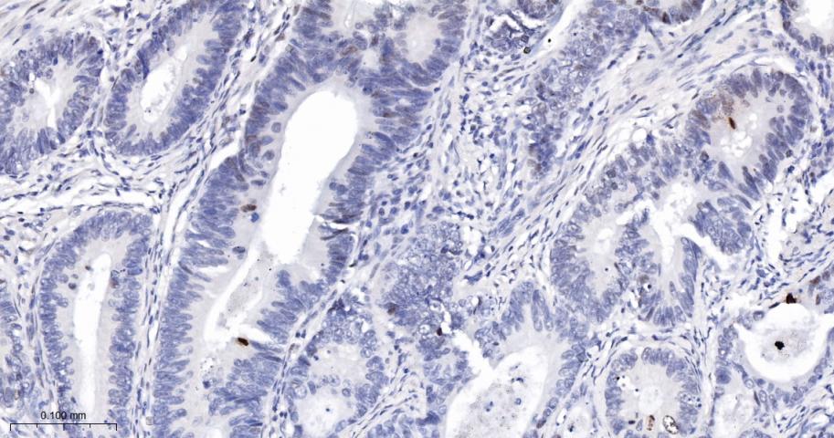 phospho-Histone H3 (S10) Recom