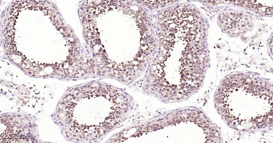 NDUFS3 Recombinant Rabbit mAb(