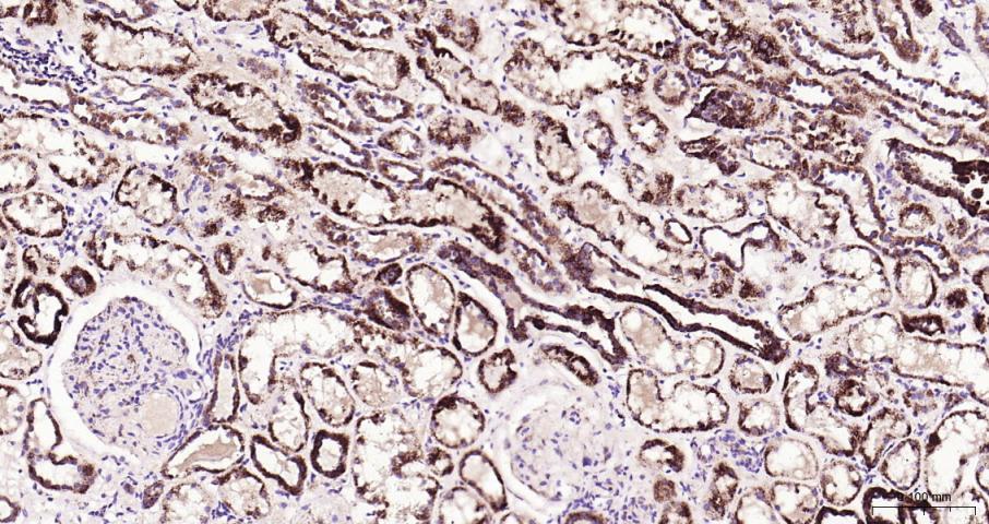 Adrenodoxin Recombinant Rabbit