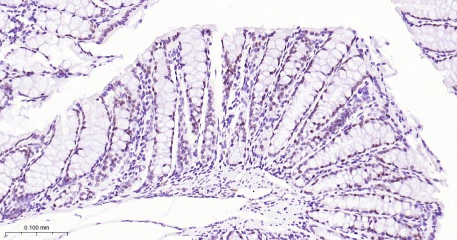 SATB2 Recombinant Rabbit mAb(b