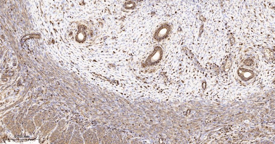 beta Actin Recombinant Rabbit 