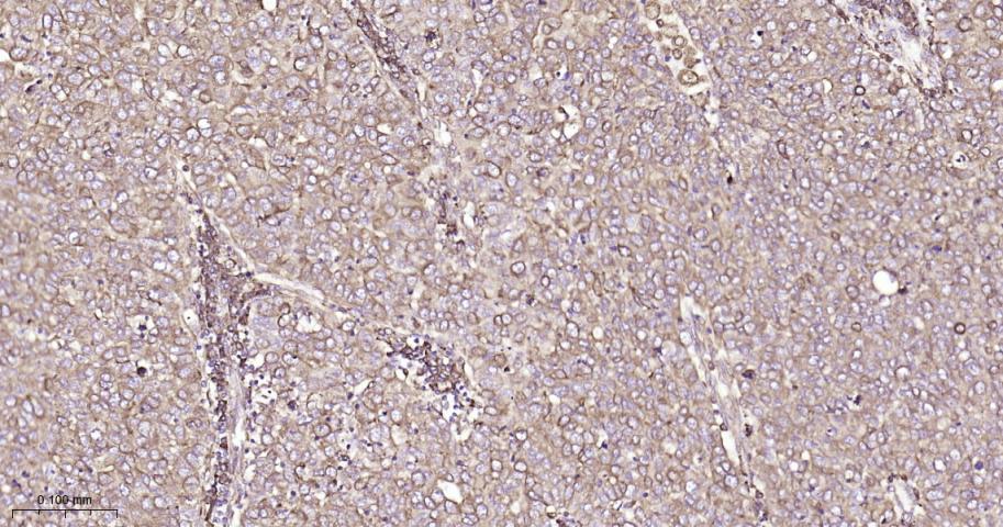 P4HB Recombinant Rabbit mAb(bs