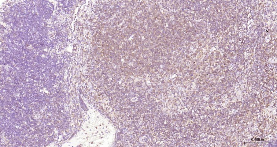 NFKB p65 Recombinant Rabbit mA