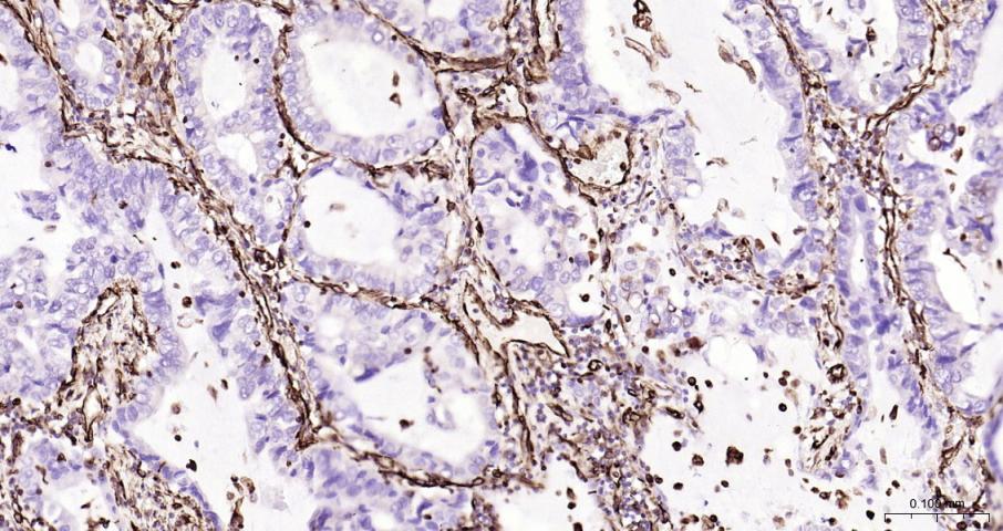 Vimentin Recombinant Rabbit mA