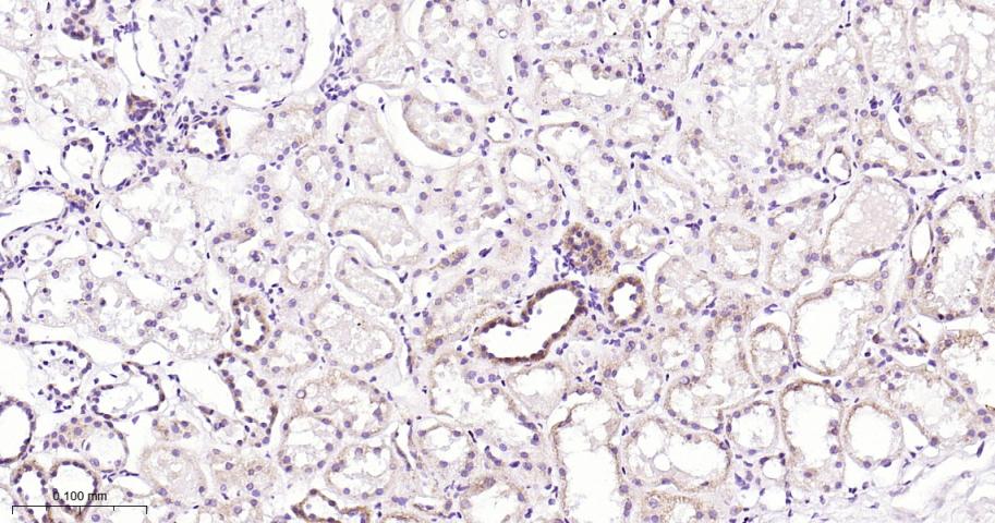 NDUFS3 Recombinant Rabbit mAb(