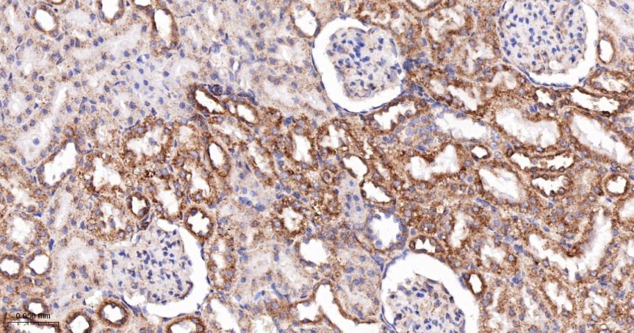 SERCA2 Recombinant Rabbit mAb(