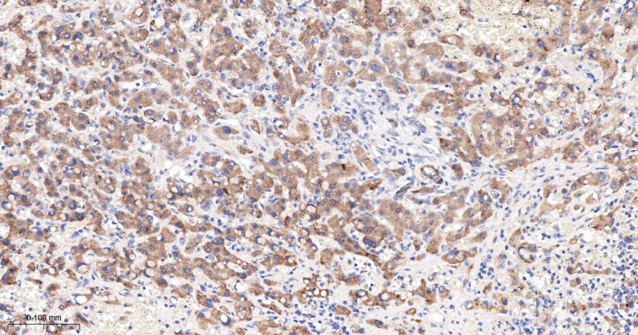SERCA2 Recombinant Rabbit mAb(