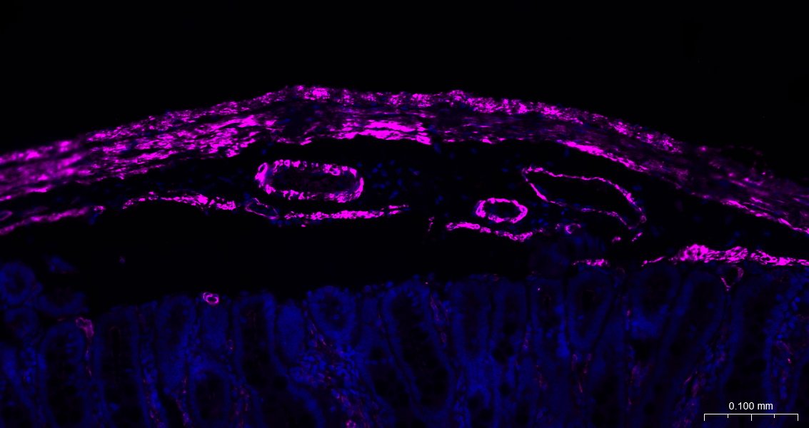 alpha smooth muscle Actin Mous