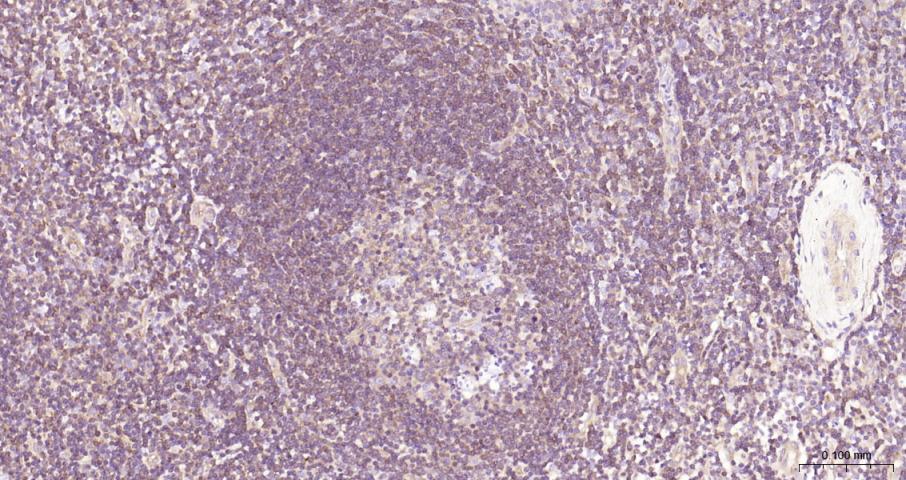 NFKB p65 Recombinant Rabbit mA