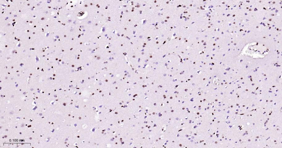 CTBP2 Recombinant Rabbit mAb(b