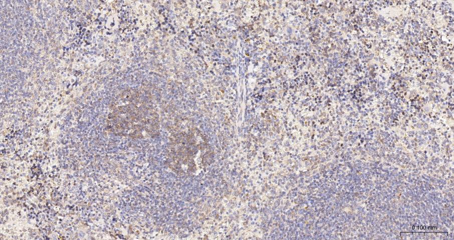 beta I Tubulin Recombinant Rab