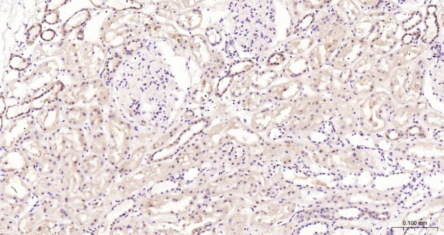 eIF4E Recombinant Rabbit mAb(b