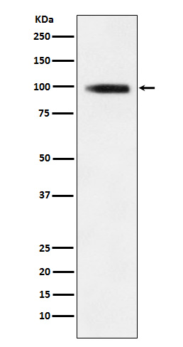 GIT1 Recombinant Rabbit mAb(bs