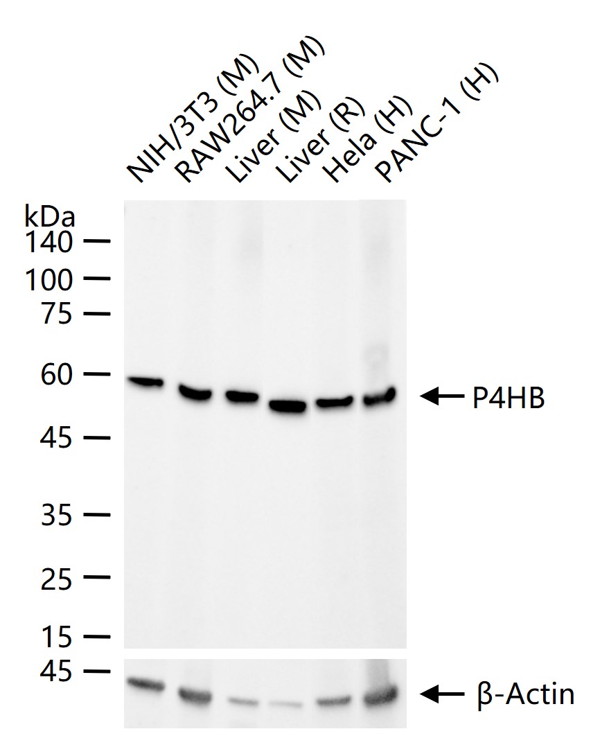 P4HB Recombinant Rabbit mAb(bs