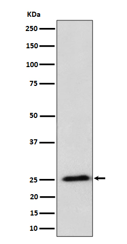 RPL10A Recombinant Rabbit mAb(