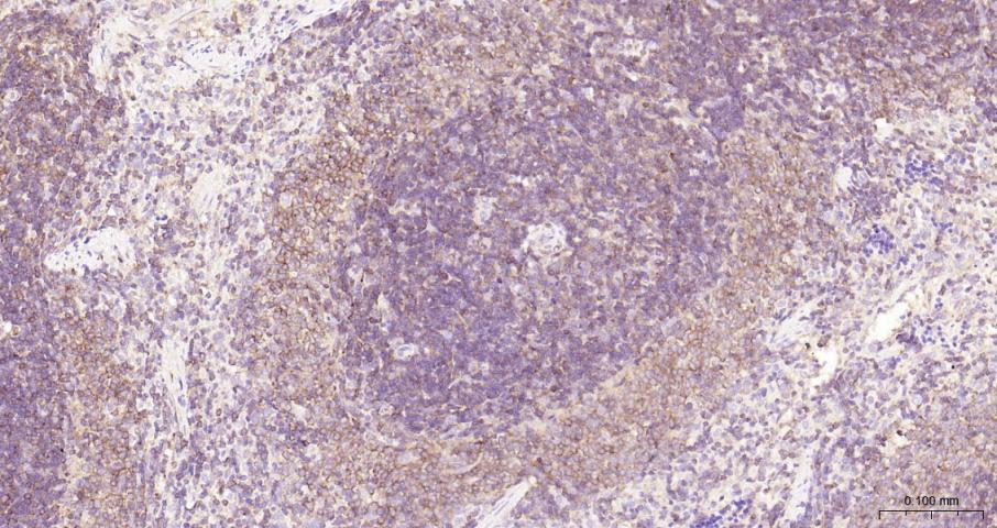 NFKB p65 Recombinant Rabbit mA