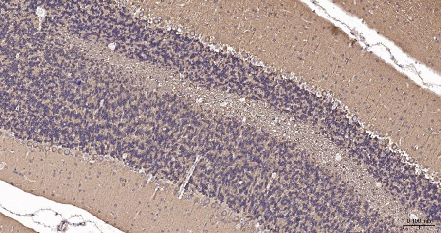 beta I Tubulin Recombinant Rab