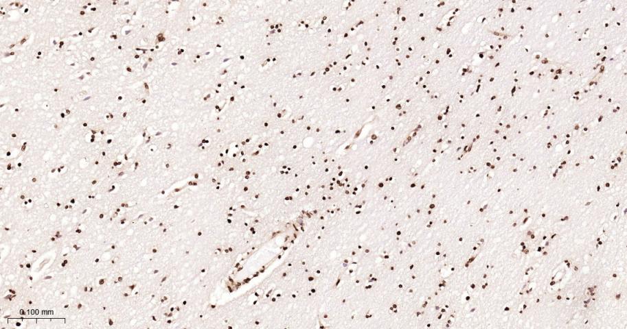 Histone H2A Recombinant Rabbit