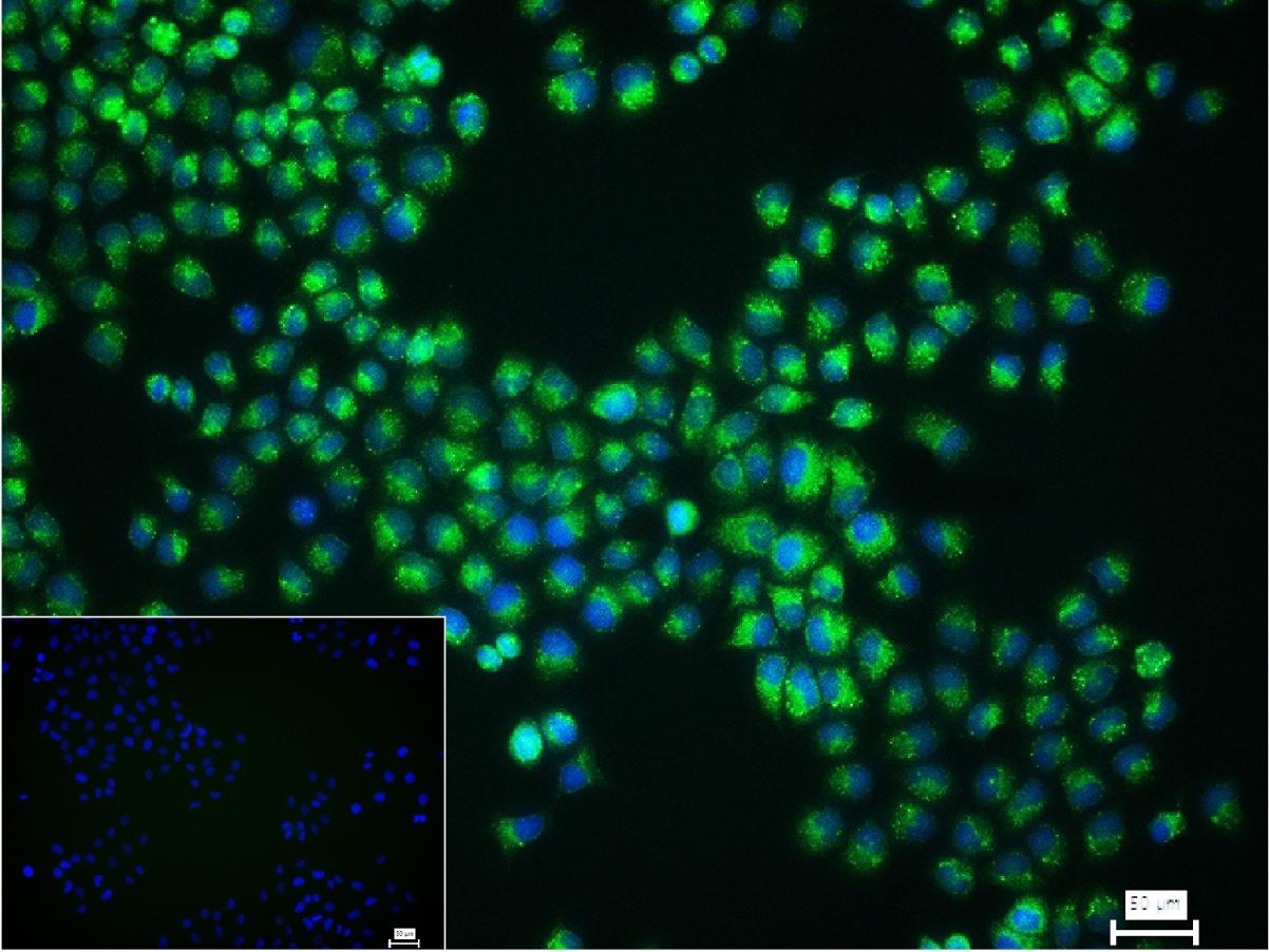 P4HB Recombinant Rabbit mAb(bs
