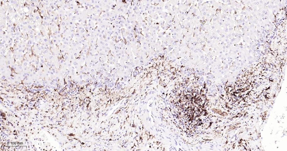HLA-DRA Mouse mAb(bsm-51091M)-