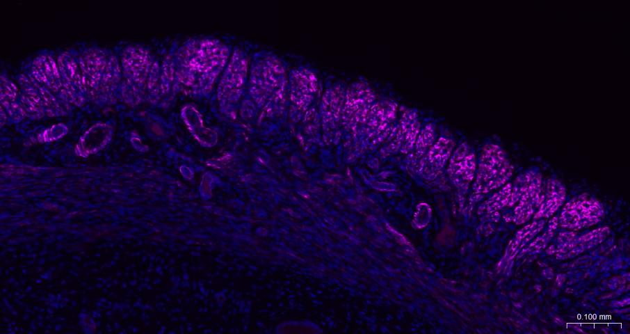 alpha smooth muscle Actin Mous