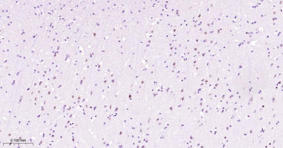 SATB2 Recombinant Rabbit mAb(b