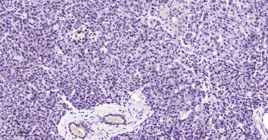 RCC1 Recombinant Rabbit mAb(bs