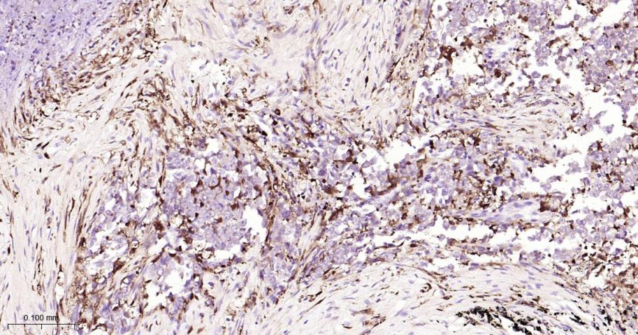 CD16 Recombinant Rabbit mAb(bs