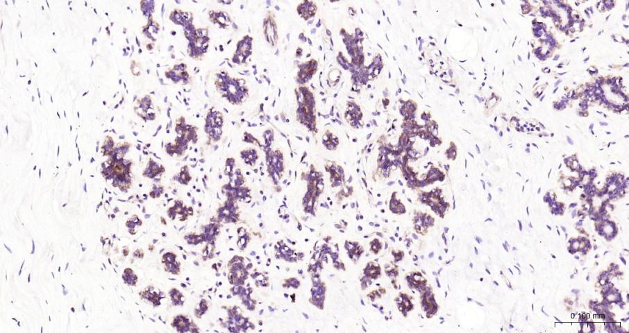 NFKB p65 Recombinant Rabbit mA