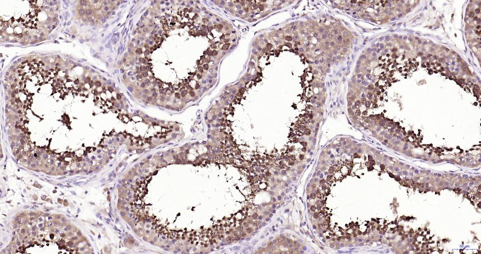 GPX4 Recombinant Rabbit mAb(bs