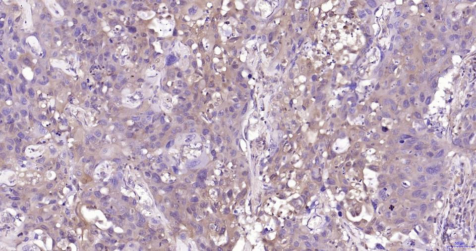 GPX4 Recombinant Rabbit mAb(bs