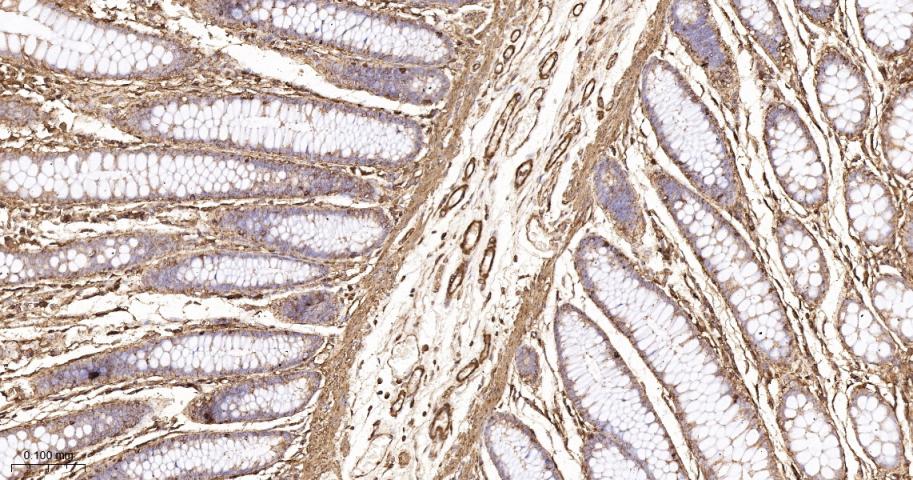 beta Actin Recombinant Rabbit 