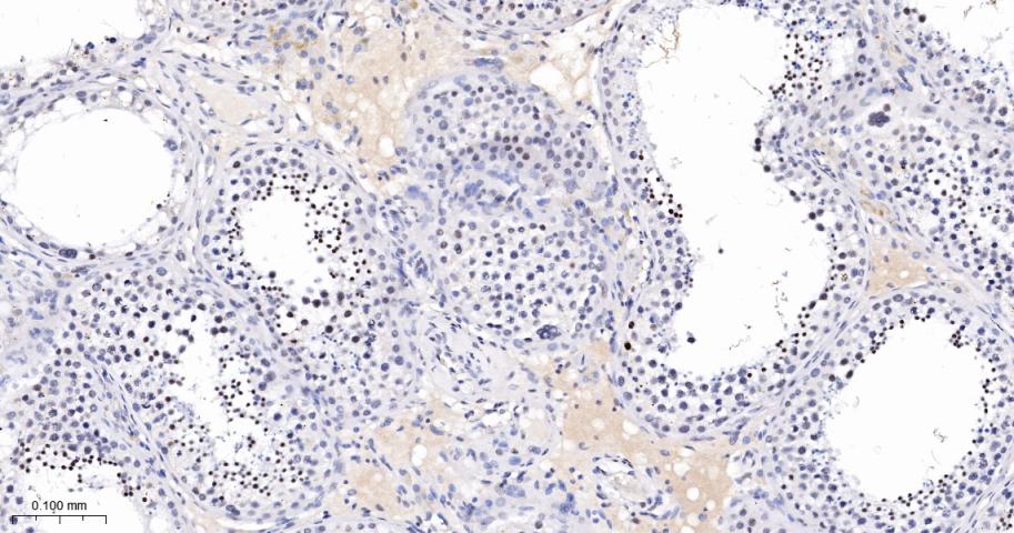 phospho-Histone H3 (S10) Recom