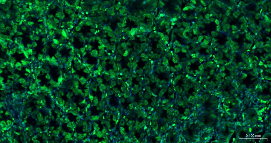 eIF4E Recombinant Rabbit mAb(b