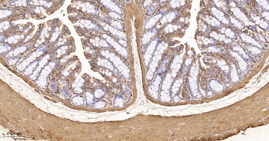 beta Actin Recombinant Rabbit 