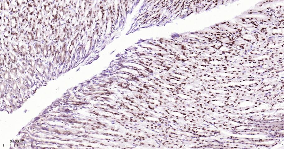 CTBP2 Recombinant Rabbit mAb(b