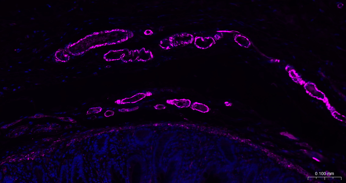 alpha smooth muscle Actin Mous
