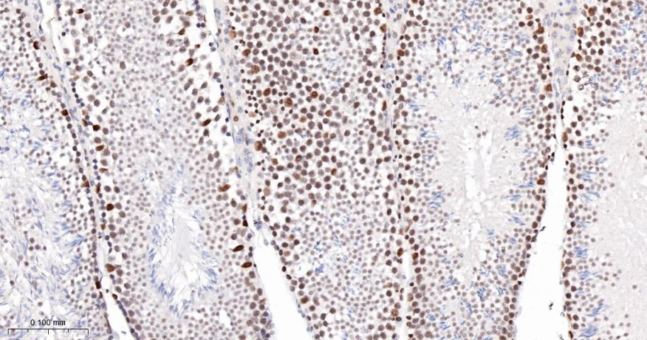 Oct-1 Recombinant Rabbit mAb(b