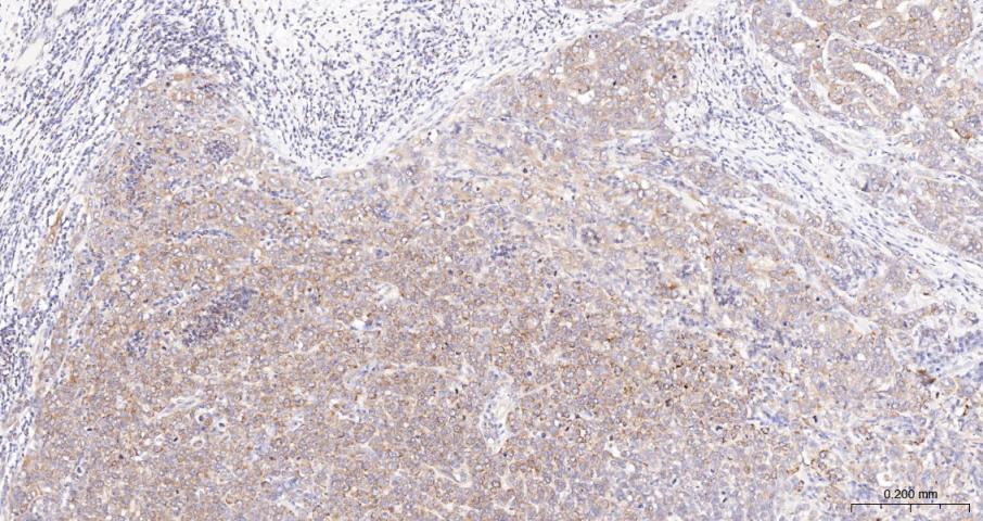 beta I Tubulin Recombinant Rab