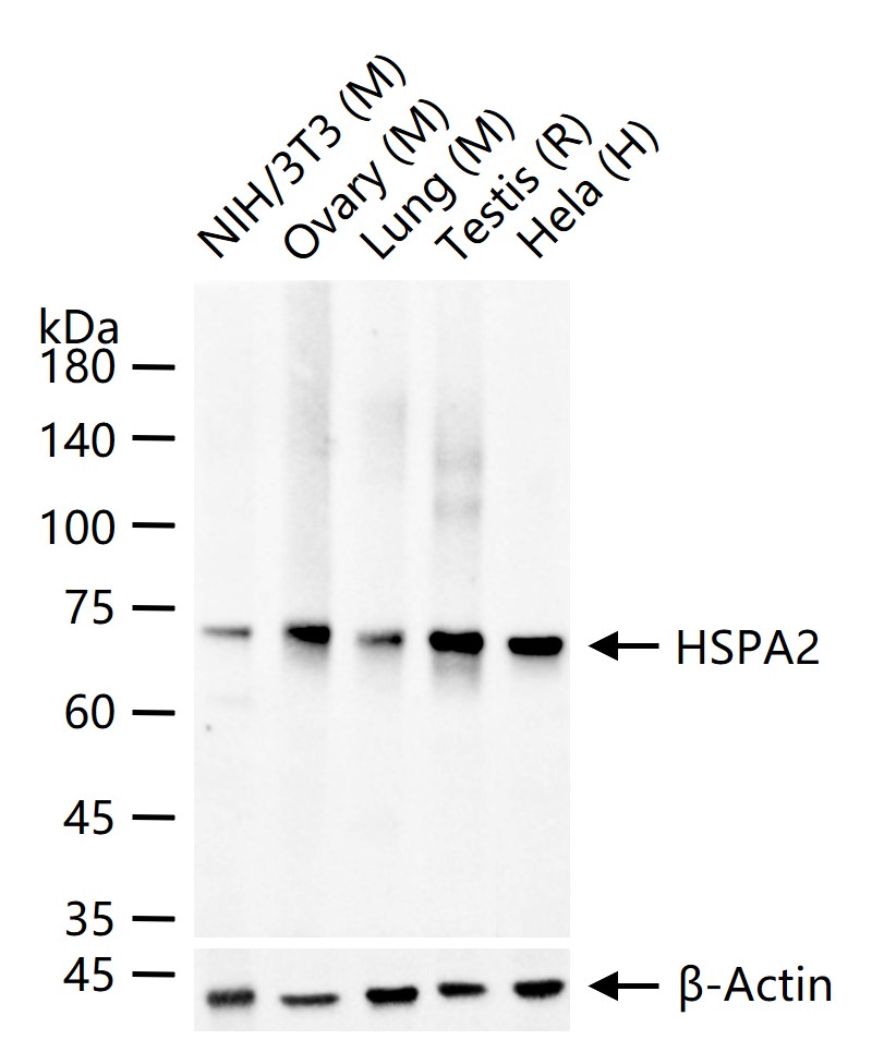 HSPA2 Recombinant Rabbit mAb(b