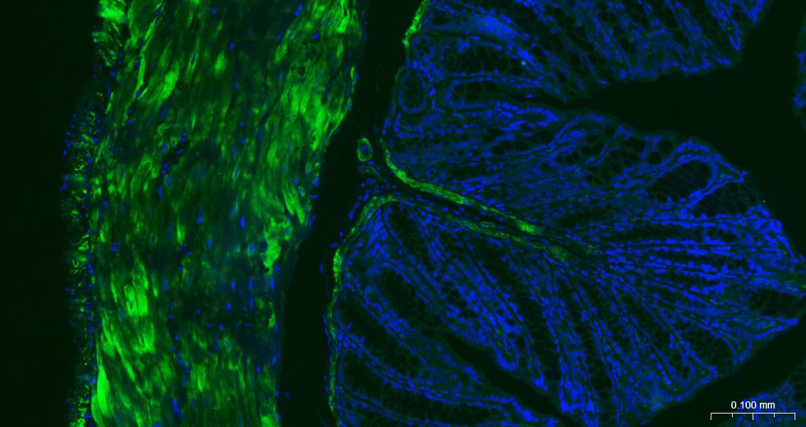 alpha smooth muscle Actin Mous