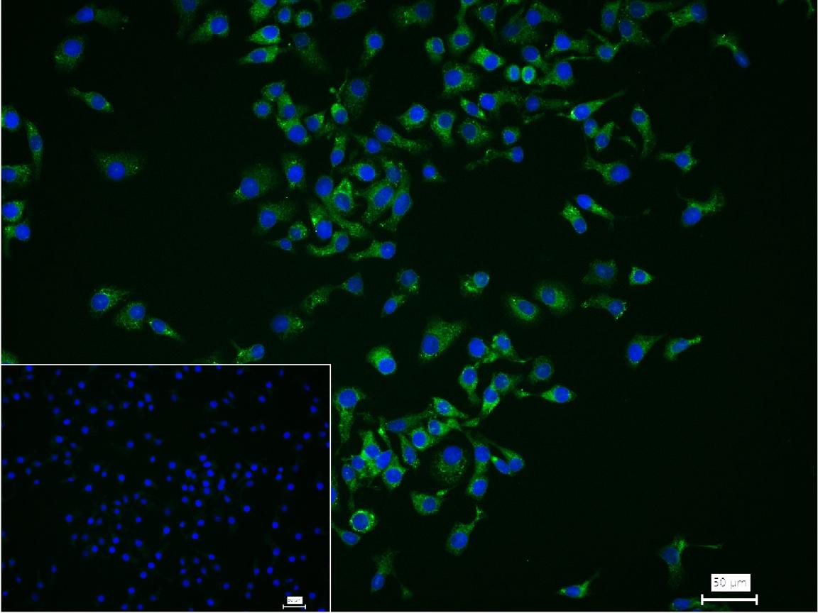 SERCA2 Recombinant Rabbit mAb(