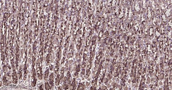RAB8A Recombinant Rabbit mAb(b