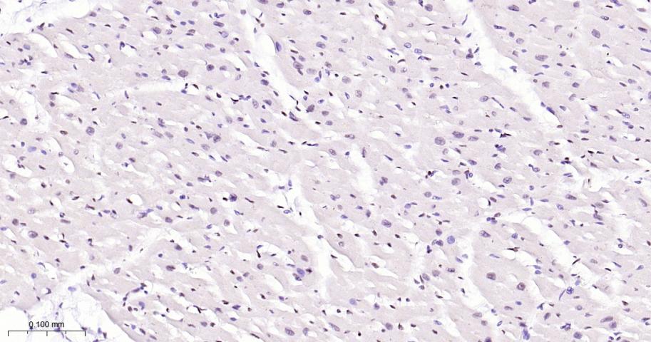 CTBP2 Recombinant Rabbit mAb(b