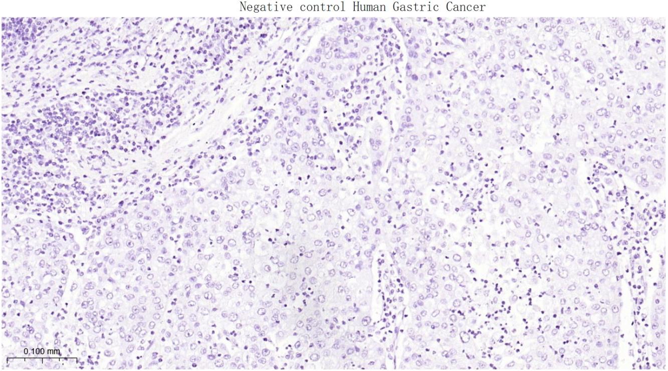 SATB2 Recombinant Rabbit mAb(b