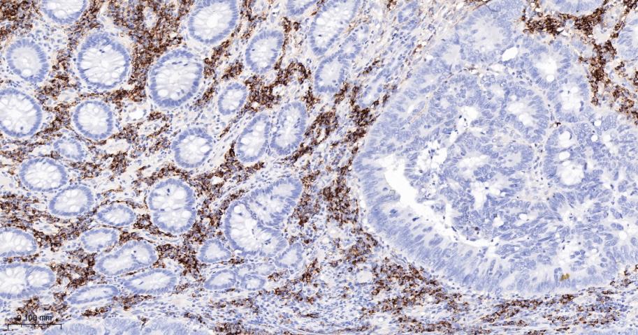 CD38 Mouse mAb(bsm-43703M)-50u
